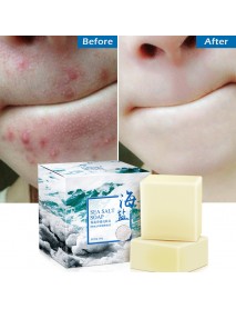 100g Removal Pimple Pore Acne Treatment Sea Salt Soap Cleaner Moisturizing Goat Milk Soap Face Care Wash Basis Soap
